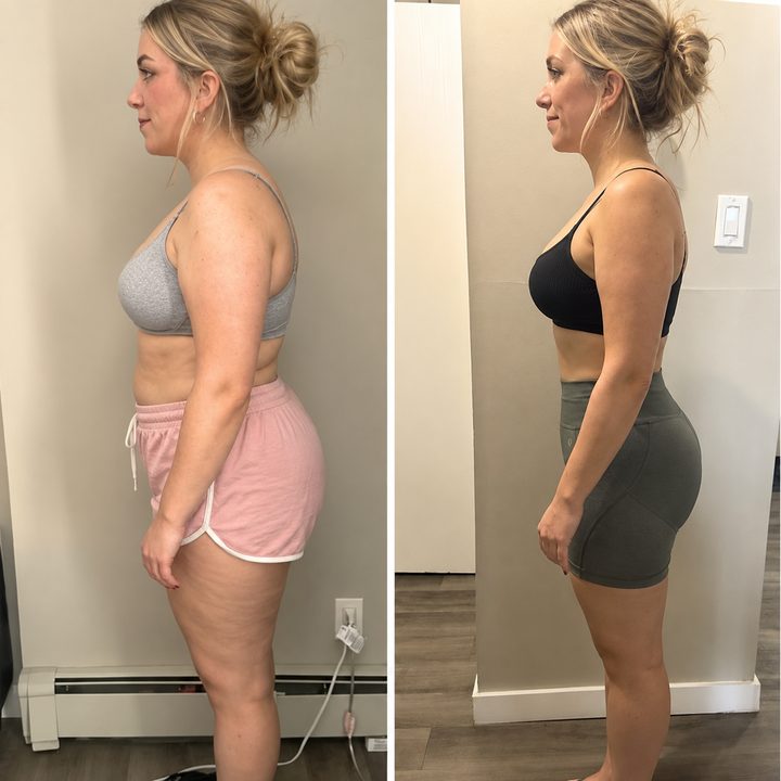 Before and after 3