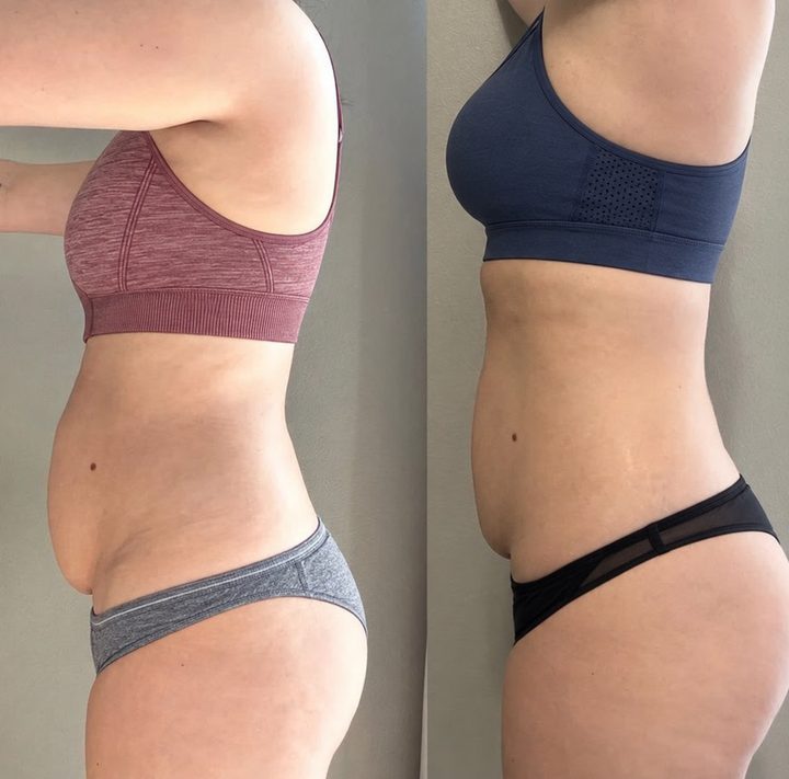 Before and after 7