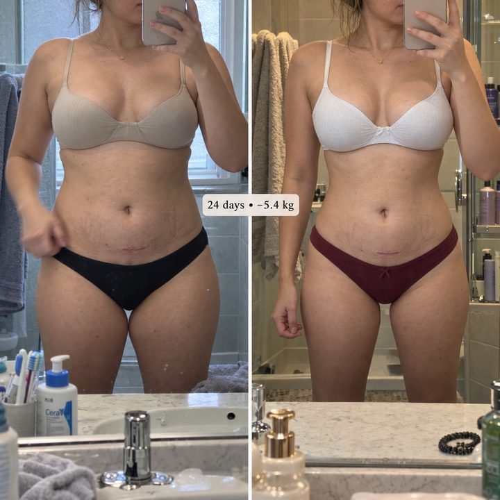 Before and after 5